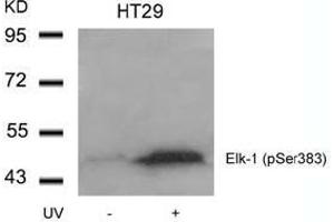Image no. 1 for anti-ELK1, Member of ETS Oncogene Family (ELK1) (pSer383) antibody (ABIN196615) (ELK1 antibody  (pSer383))