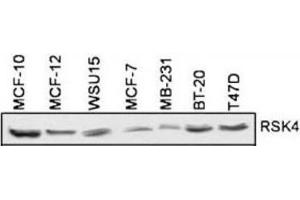 Western Blotting (WB) image for anti-Ribosomal Protein S6 Kinase, 90kDa, Polypeptide 6 (RPS6KA6) antibody (ABIN3003591) (RPS6KA6 antibody)