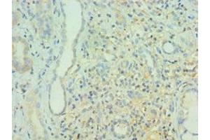 Immunohistochemistry of paraffin-embedded human kidney tissue using ABIN7160382 at dilution of 1:100 (BIN1 antibody  (AA 414-593))