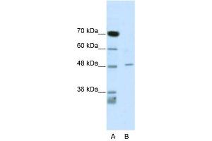 CACNB4 antibody used at 1 ug/ml to detect target protein.