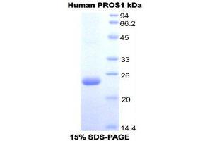 SDS-PAGE (SDS) image for Protein S (PROS) (AA 301-476) protein (His tag) (ABIN1171225)