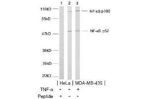 Image no. 2 for anti-Nuclear Factor of kappa Light Polypeptide Gene Enhancer in B-Cells 2 (NFKB2) (AA 868-872) antibody (ABIN197120) (NFKB2 antibody  (AA 868-872))