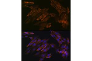 Immunofluorescence analysis of NIH-3T3 cells using DDX6 Rabbit mAb (ABIN7266703) at dilution of 1:100 (40x lens). (DDX6 antibody)