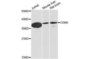 Western blot analysis of extracts of various cell lines, using CDK6 antibody. (CDK6 antibody)