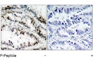 Image no. 1 for anti-Structural Maintenance of Chromosomes 1A (SMC1A) (pSer957) antibody (ABIN196936) (SMC1A antibody  (pSer957))