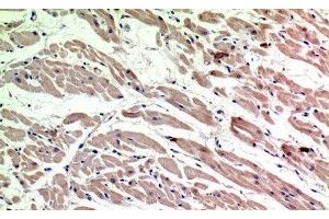 Immunohistochemistry of paraffin-embedded Human heart tissue using CD206 Polyclonal Antibody at dilution of 1:200. (Macrophage Mannose Receptor 1 antibody)