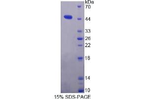 Image no. 1 for Microsomal Triglyceride Transfer Protein (MTTP) (AA 28-459) protein (His tag) (ABIN4989435)