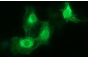 Image no. 3 for anti-Fc Fragment of IgG, High Affinity Ia, Receptor (CD64) (FCGR1A) antibody (ABIN1497349)