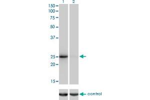 Western blot analysis of THAP1 over-expressed 293 cell line, cotransfected with THAP1 Validated Chimera RNAi (Lane 2) or non-transfected control (Lane 1).