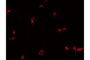 ABIN6266867 staining HeLa  cells by IF/ICC. (HEXIM1 antibody)