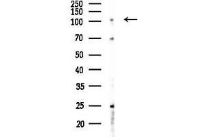 anti-ATP-Binding Cassette, Sub-Family F (GCN20), Member 1 (ABCF1) (C-Term) antibody