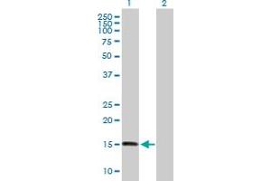 Western Blot analysis of ZNHIT1 expression in transfected 293T cell line by ZNHIT1 MaxPab polyclonal antibody. (ZNHIT1 antibody  (AA 1-154))
