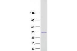 Validation with Western Blot (UNC119B Protein (Myc-DYKDDDDK Tag))