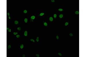 Immunofluorescence (IF) image for anti-Histone Cluster 1, H3a (HIST1H3A) (pThr6) antibody (ABIN7139629)