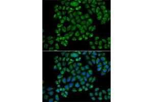 Immunofluorescence analysis of HeLa cells using GRI antibody (ABIN6127964, ABIN6141386, ABIN6141387 and ABIN6218189). (Glutamate Receptor 3 antibody  (AA 200-490))