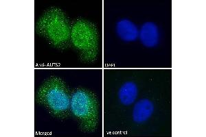 ABIN308459 Immunofluorescence analysis of paraformaldehyde fixed U2OS cells, permeabilized with 0. (AUTS2 antibody  (C-Term))