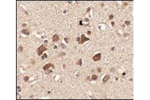 Immunohistochemistry of Slitrk6 in human brain tissue with this product at 2. (SLITRK6 antibody  (C-Term))