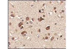 Immunohistochemistry of Slitrk6 in human brain tissue with this product at 2.