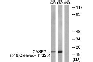 Western blot analysis of extracts from rat lung cells and rat heart cells, using CASP2 (p18, Cleaved-Thr325) antibody. (Caspase 2 antibody  (Cleaved-Thr325, Subunit p18))