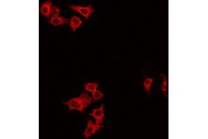 ABIN6266834 staining HeLa by IF/ICC. (DIRAS1 antibody  (C-Term))