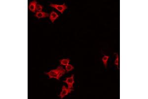 ABIN6266834 staining HeLa by IF/ICC. (DIRAS1 antibody  (C-Term))