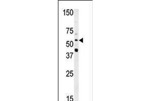 Western blot analysis of anti-NMT2 Pab in HepG2 cell line lysate (35ug/lane) (NMT2 antibody  (N-Term))