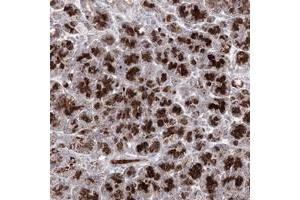 Immunohistochemical staining of human pancreas with C11orf80 polyclonal antibody  shows strong granular cytoplasmic positivity in exocrine glandular cells at 1:10-1:20 dilution.