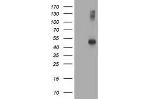 HEK293T cells were transfected with the pCMV6-ENTRY control (Left lane) or pCMV6-ENTRY AP2M1 (Right lane) cDNA for 48 hrs and lysed. (AP2M1 antibody  (AA 97-383))