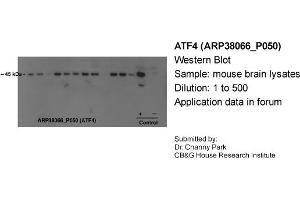 Western Blotting (WB) image for anti-Activating Transcription Factor 4 (Tax-Responsive Enhancer Element B67) (ATF4) (N-Term) antibody (ABIN2780377) (ATF4 antibody  (N-Term))