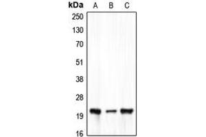 Western blot analysis of Claudin 7 expression in HEK293T (A), Raw264. (Claudin 7 antibody  (C-Term))