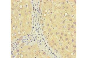 Immunohistochemistry of paraffin-embedded human liver tissue using ABIN7176405 at dilution of 1:100 (ZNF583 antibody  (AA 1-300))