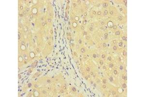 Immunohistochemistry of paraffin-embedded human liver tissue using ABIN7176405 at dilution of 1:100 (ZNF583 antibody  (AA 1-300))