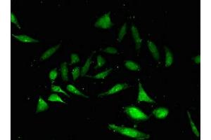 Immunofluorescent analysis of Hela cells using ABIN7161039 at dilution of 1:100 and Alexa Fluor 488-congugated AffiniPure Goat Anti-Rabbit IgG(H+L) (NANOS3 antibody  (AA 21-192))
