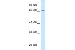 WB Suggested Anti-prd Antibody Titration:  0. (Primary Retinal Dysplasia (PRD) (Middle Region) antibody)