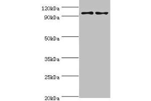 Western blot All lanes: NLGN4Y antibody at 6 μg/mL Lane 1: A549 whole cell lysate Lane 2: Mouse brain tissue Secondary Goat polyclonal to rabbit IgG at 1/10000 dilution Predicted band size: 93, 73, 16, 29 kDa Observed band size: 93 kDa