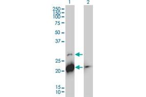 Western Blot analysis of BID expression in transfected 293T cell line by BID monoclonal antibody (M01), clone 3F3-1A3. (BID antibody  (AA 1-195))