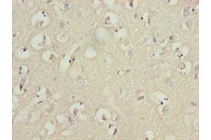 Immunohistochemistry of paraffin-embedded human brain tissue using ABIN7173675 at dilution of 1:100 (TUBB1 antibody  (AA 270-451))