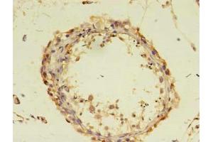 Immunohistochemistry of paraffin-embedded human testis tissue using ABIN7149583 at dilution of 1:100 (DOCK1 antibody  (AA 1645-2186))