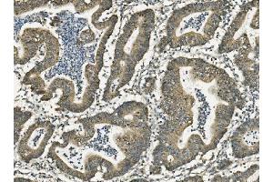 IHC analysis of FABP6 using anti-FABP6 antibody (ABIN7598974).