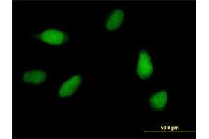 Immunofluorescence of purified MaxPab antibody to SCC-112 on HeLa cell. (PDS5A antibody  (AA 1-333))