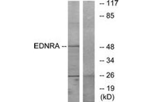 Western blot analysis of extracts from HepG2 cells, using EDNRA Antibody. (Endothelin-1 Receptor antibody  (AA 378-427))