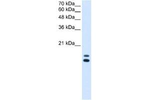 WB Suggested Anti-UXT Antibody Titration:  2. (UXT antibody  (N-Term))