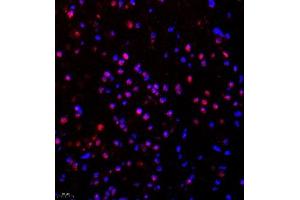 Immunofluorescence of paraffin embedded mouse brain using SR140 (ABIN7076091) at dilution of 1:600 (400x lens) (SR140 antibody)