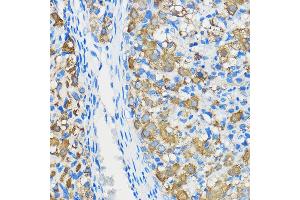 Immunohistochemistry (IHC) image for anti-Activating Transcription Factor 6 (ATF6) (AA 1-190) antibody (ABIN1512605)