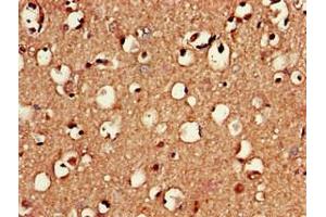 Immunohistochemistry of paraffin-embedded human brain tissue using ABIN7150991 at dilution of 1:100 (RNF4 antibody  (AA 471-724))