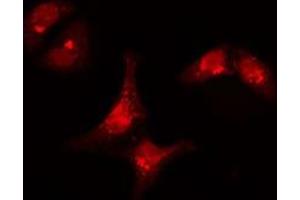 ABIN6277308 staining  Hela cells by IF/ICC.