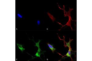 Immunocytochemistry (ICC) image for anti-Calcium Channel, Voltage-Dependent, L Type, alpha 1C Subunit (CACNA1C) (AA 1507-1733) antibody (Atto 594) (ABIN2485649)