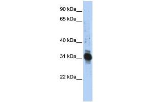 WB Suggested Anti-ZFAND3 Antibody Titration:  0. (ZFAND3 antibody  (Middle Region))