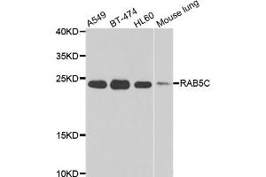 Western blot analysis of extracts of various cell lines, using RAB5C antibody (ABIN5975504) at 1/1000 dilution. (Rab5c antibody)
