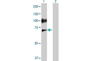 Western Blot analysis of SELE expression in transfected 293T cell line by SELE MaxPab polyclonal antibody. (Selectin E/CD62e antibody  (AA 1-610))